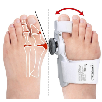 Ortéza na vbočený palec s kloubem - jak zastavit hallux valgus