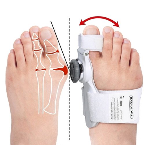 Orteza na vbočený palec s kloubem Bandáž Hallux Valgus